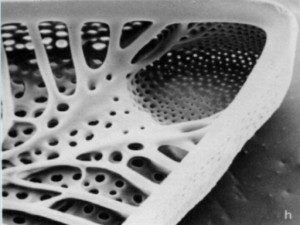 SEM of Diatom